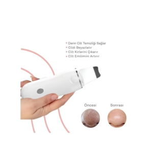 Ultrasonik Spatula Yüz Akne Giderici Siyah Nokta Temizleme Cihazı